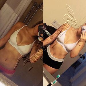 before and after breast