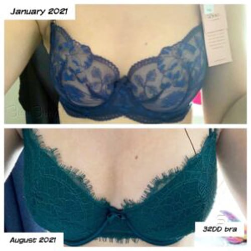 Woman showing breast growth after using Bust Bunny